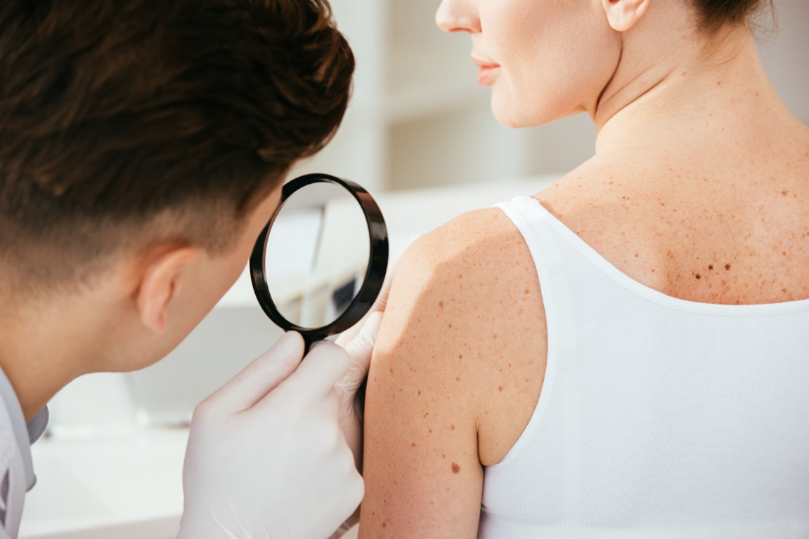 Cuidado de la Piel: Detección Temprana de Cáncer de Piel con Biopsias y Dermatoscopias